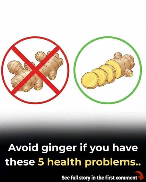 Don’t use ginger if you belong to any of these 5 groups of people