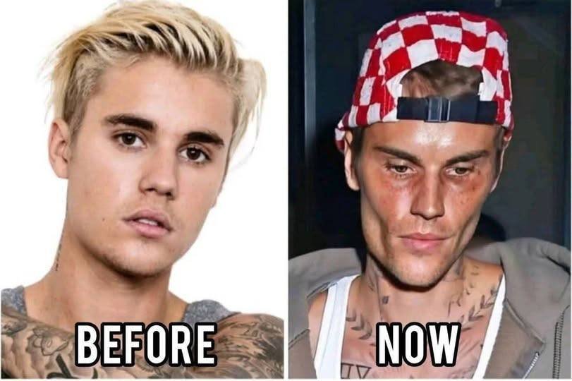 Justin Bieber Admits He Tested Positive for