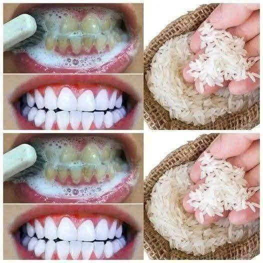 🦷 Teeth Whitening Trick with Rice — A Natural, 1-Minute Smile Brightener (Or Cautionary Tale?)