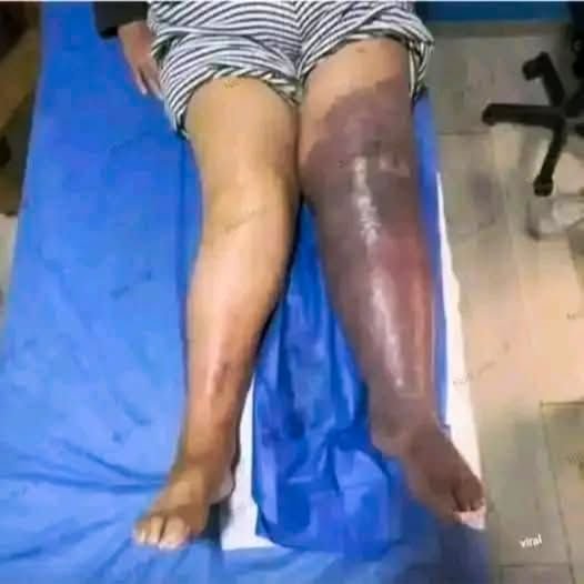 The Shocking Consequences of Sleeping With the