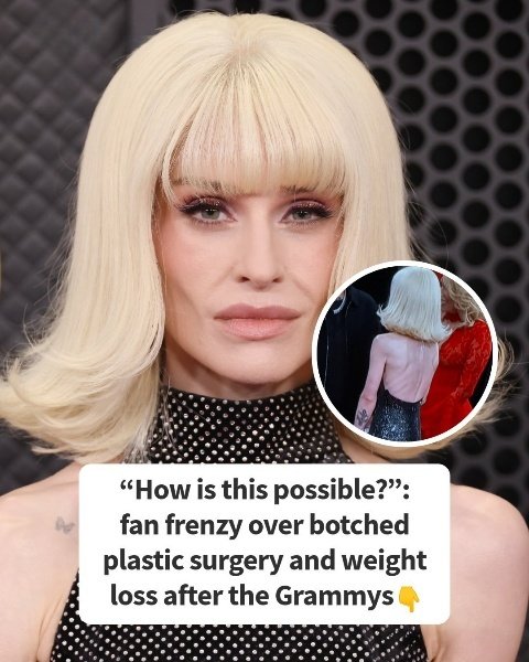 Social media erupts over botched cosmetic procedures and dramatic weight changes after the Grammys. Learn more in the comments below…