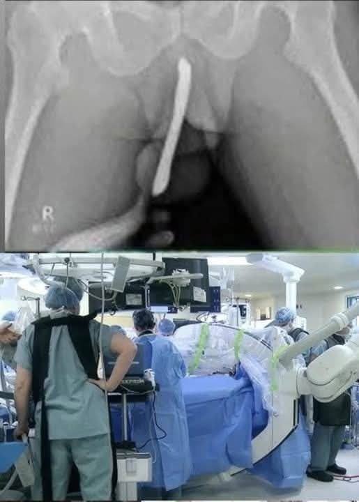 Hospitalized After Risky Experiment