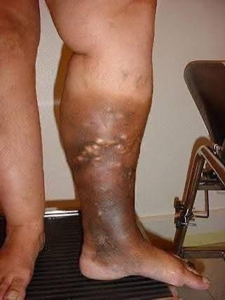 These are the signs that he is cr… See more👨🏻🦽➡️