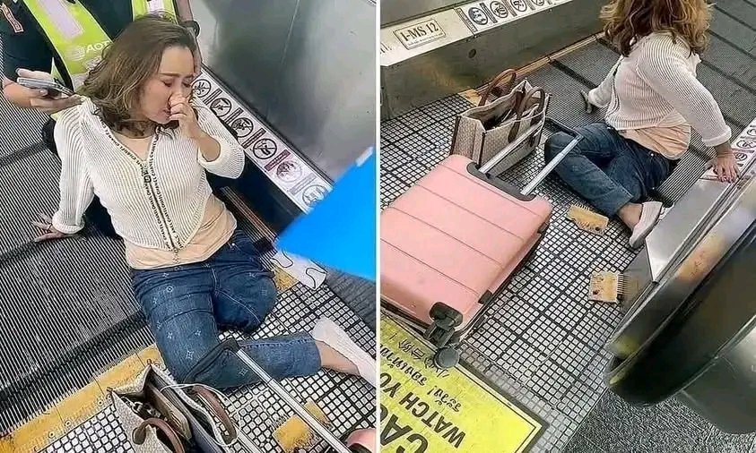 57-year-old woman, LOSES her leg after getting STUCK on an escalator in the… See more