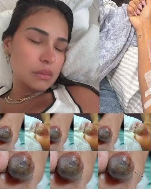 Doctors Warn About The Dangerous Consequences Hidden Behind One Night