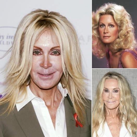 She’s 82 and still turning heads – better sit before you see her stunning transformation