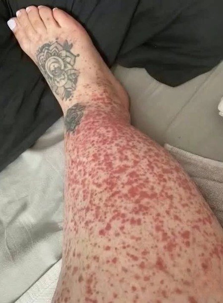 Here Are the Shocking Consequences of What Started as Just One Night