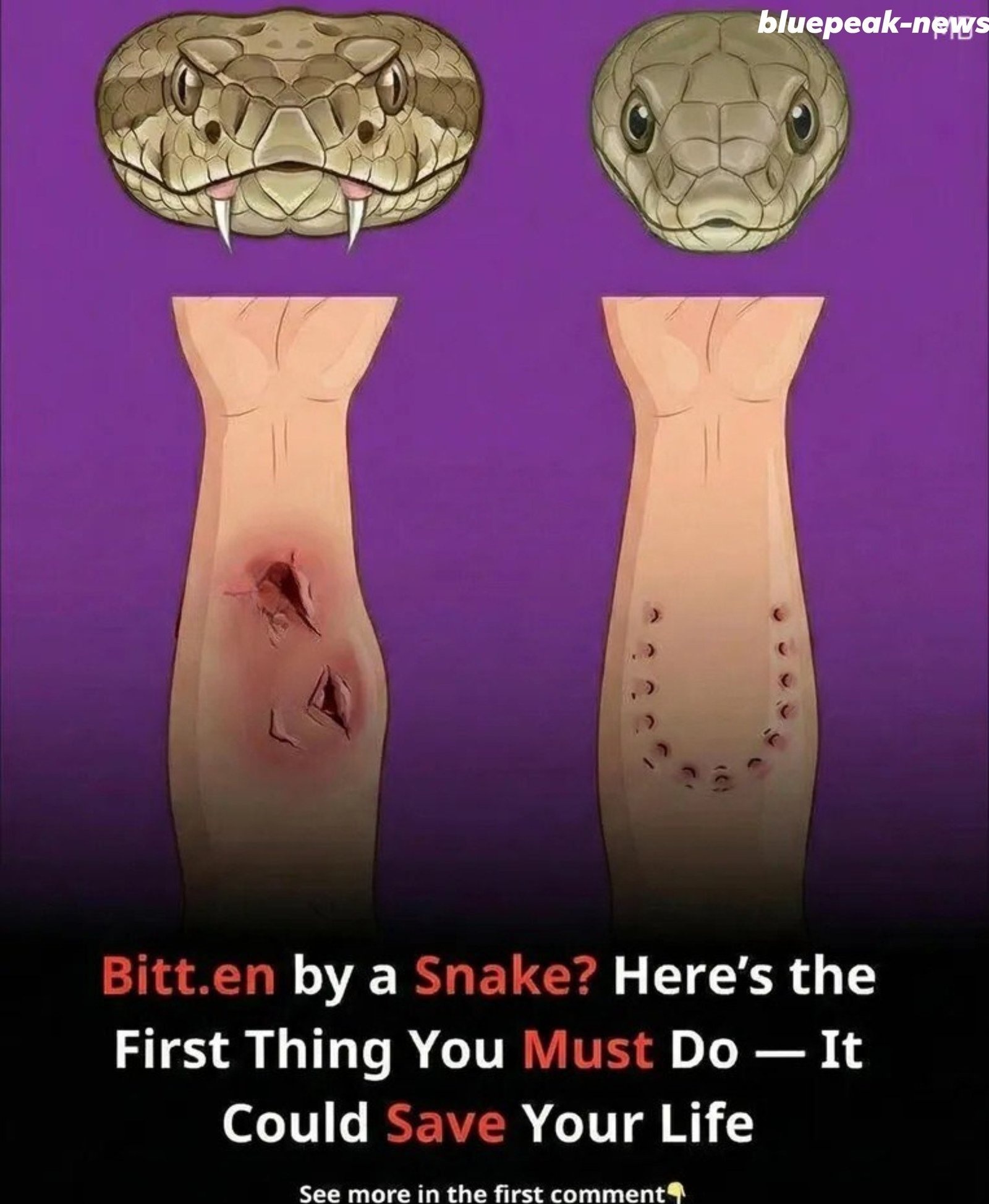 Bitten by a Snake? The First Thing You Do Could Save Your Life