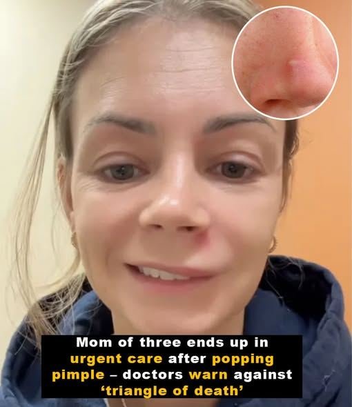 Danger Triangle Pimple Warning