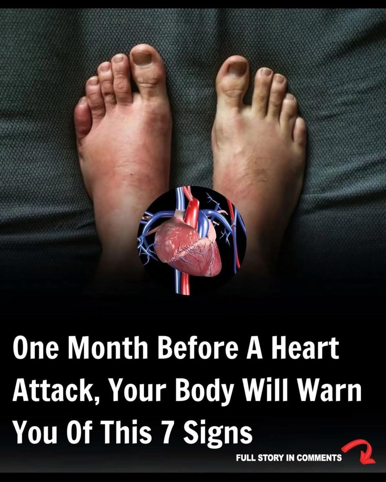 One Month Before a Heart Attack, Your Body May Warn You With These 7 Signs