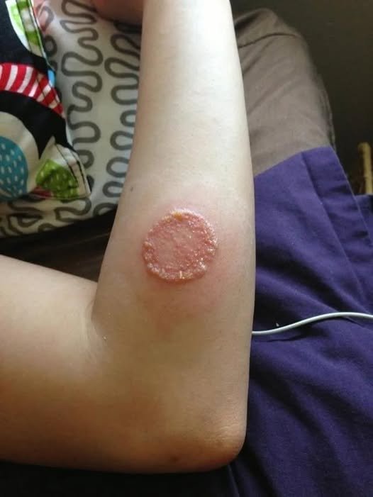 ALERT: These are the signs that it is cre…See more