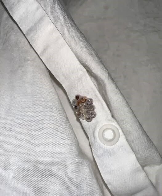 Strange Objects Appeared on My Bed Sheets — The Discovery Left Me Stunned