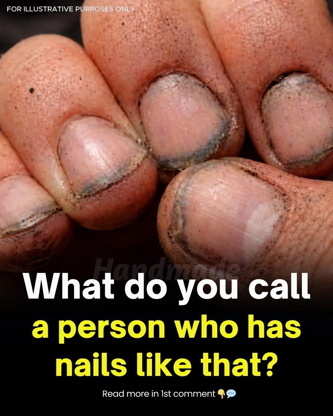 What Dirty Fingernails Really Reveal