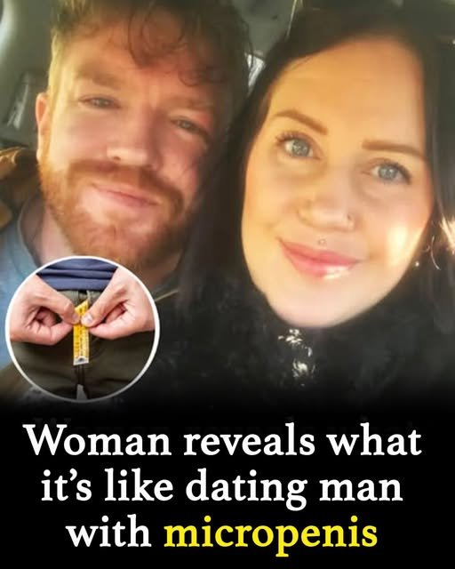 Woman opens up about love, laughs & life with her micro penis man