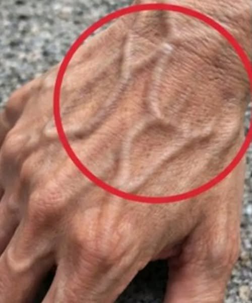 If you have visible veins, it means you are… See more
