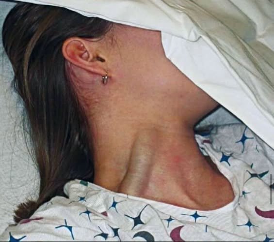 She Woke Up With Marks She Couldn’t Explain